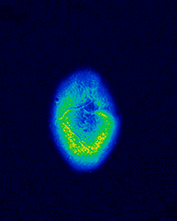 High-resolution color PET-style scan of the human brain cycling through successive layers